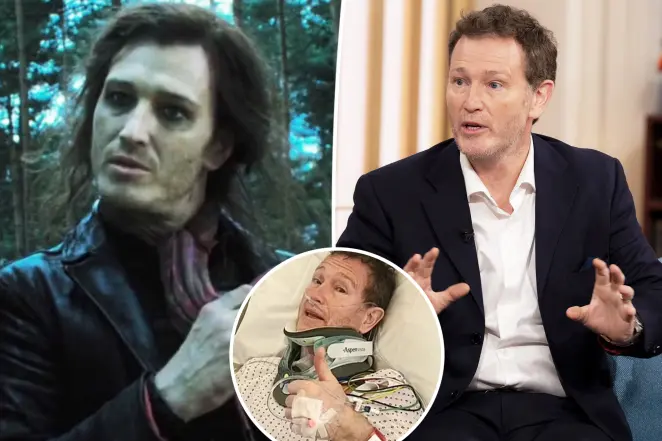 ‘Harry Potter’ actor rushed to hospital with ‘life-threatening’ injury, told he ‘might never walk or talk again’